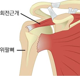 정상 회전근개 이미지